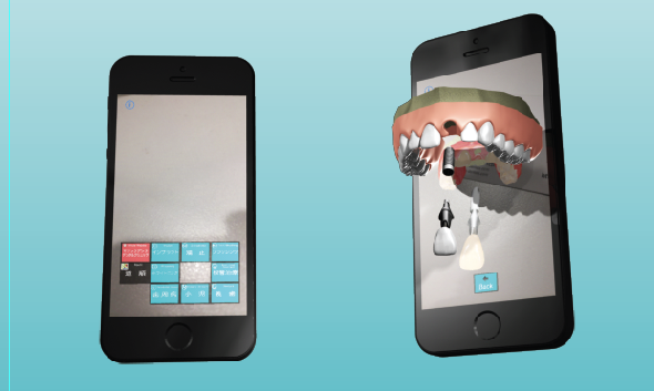 マジックデンタキャプ